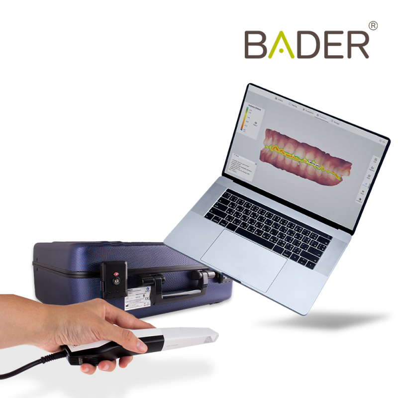 oral scanner 4 bader dental