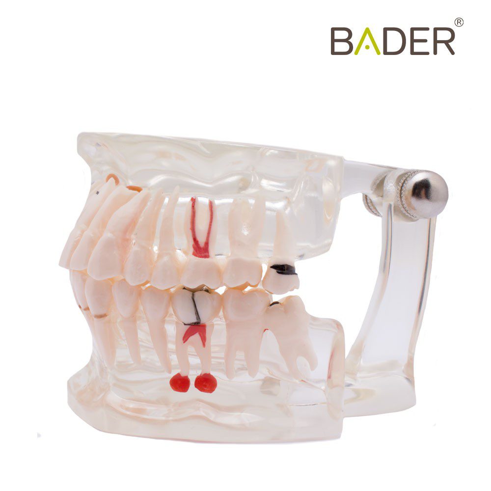 4552-Modelo-dental-transparente-con-implante.jpg