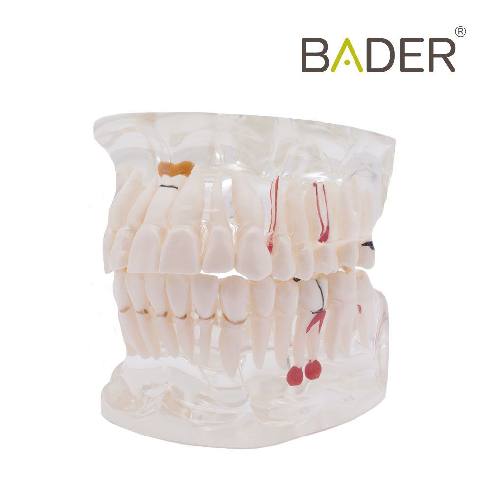 4558-Modelo-dental-transparente-con-implante.jpg